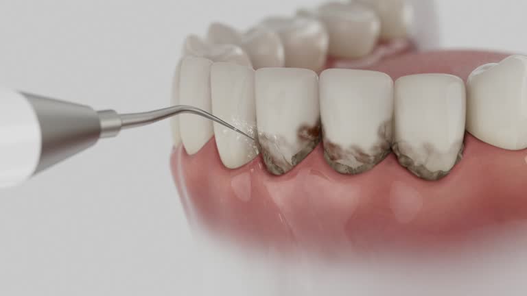 Reliable Dental contractor in Yorktown, IN by Dentist Open Now